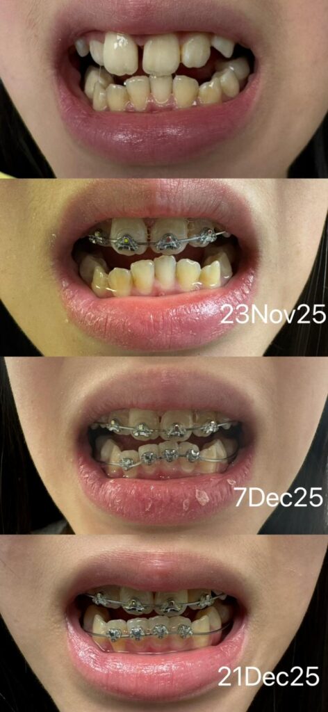 Home Ortho2 472x1024