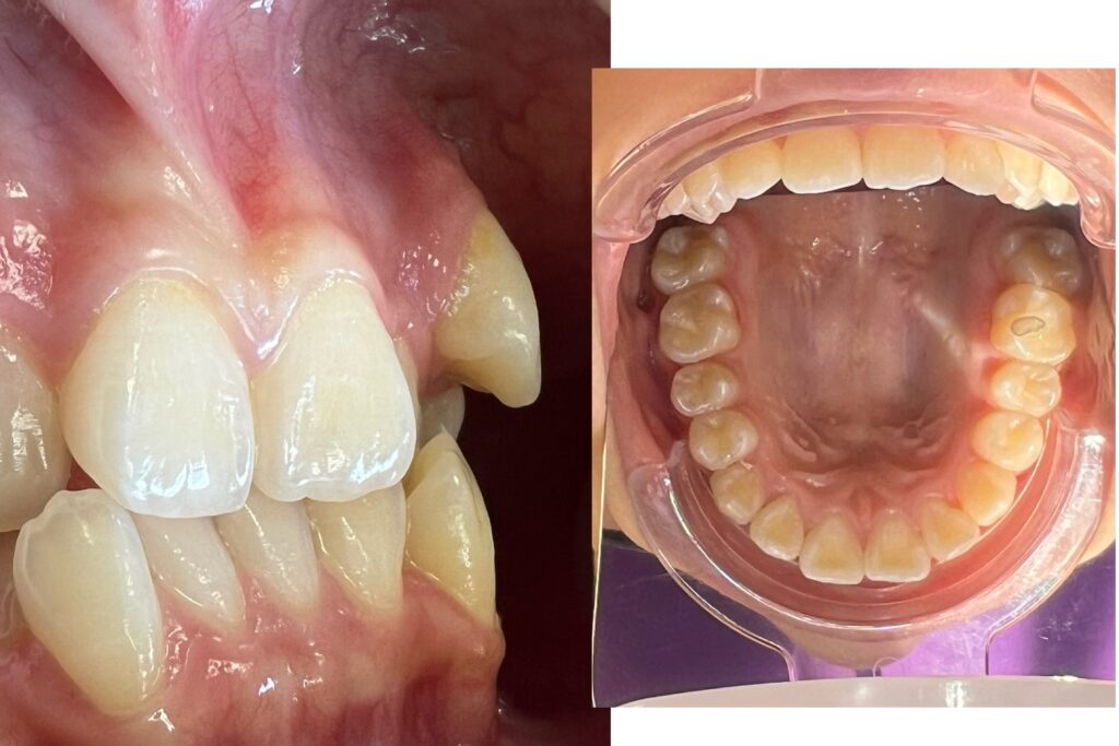 burnabymetadentalorthodontics