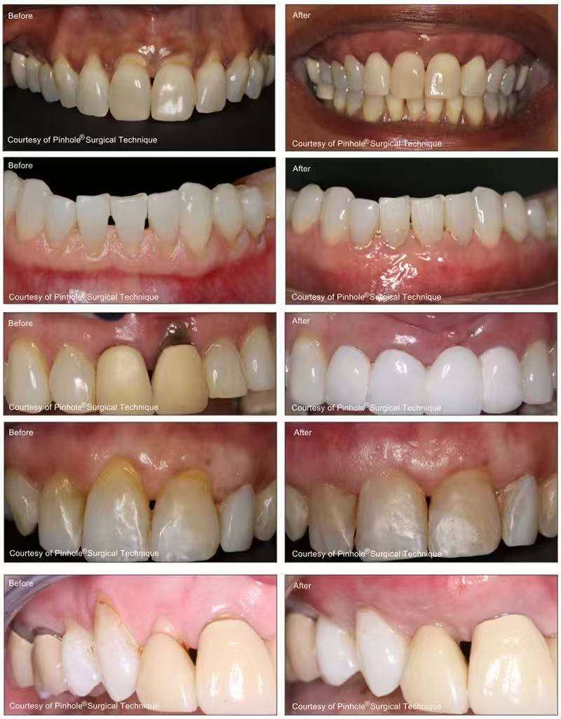 image 20260413124934